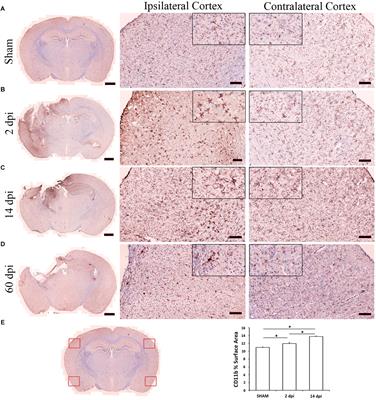 Time-Dependent Changes in Microglia Transcriptional Networks Following Traumatic Brain Injury